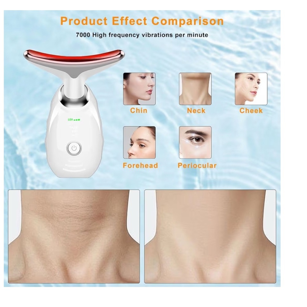 Intense Pulsed Light Wrinkle Reducing Instrument - Picture 3 of 5